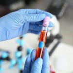 Ecco i 7 esami del sangue che ti permettono di scoprire subito ciò che il corpo non dice mai