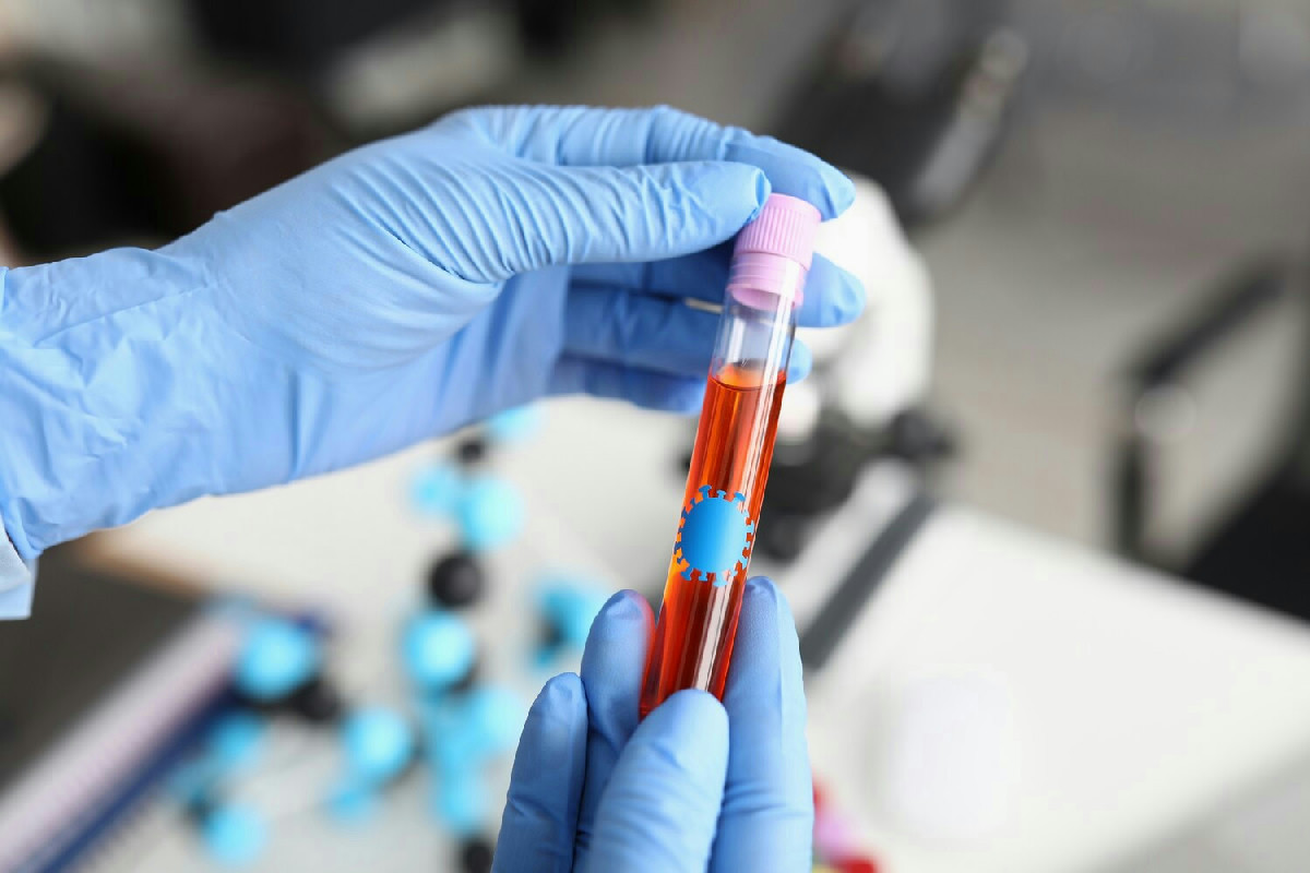 Ecco i 7 esami del sangue che ti permettono di scoprire subito ciò che il corpo non dice mai